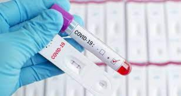 ΥΠΟΧΡΕΩΣΗ ΕΡΓΑΖΟΜΕΝΩΝ ΣΤΟ ΕΜΠΟΡΙΟ ΓΙΑ ΤΗΝ ΠΡΑΓΜΑΤΟΠΟΙΗΣΗ SELF TEST